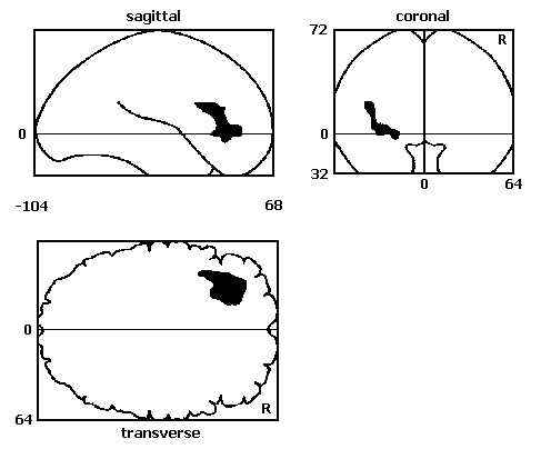 cortical activation