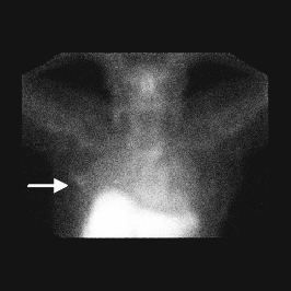 Image11.gif (26630 bytes)