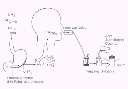 Urease Breath Test