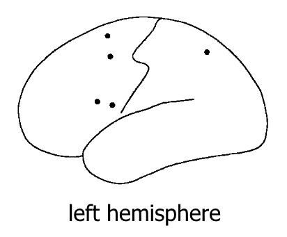 left hemisphere activation