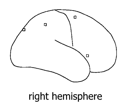left hemisphere activation