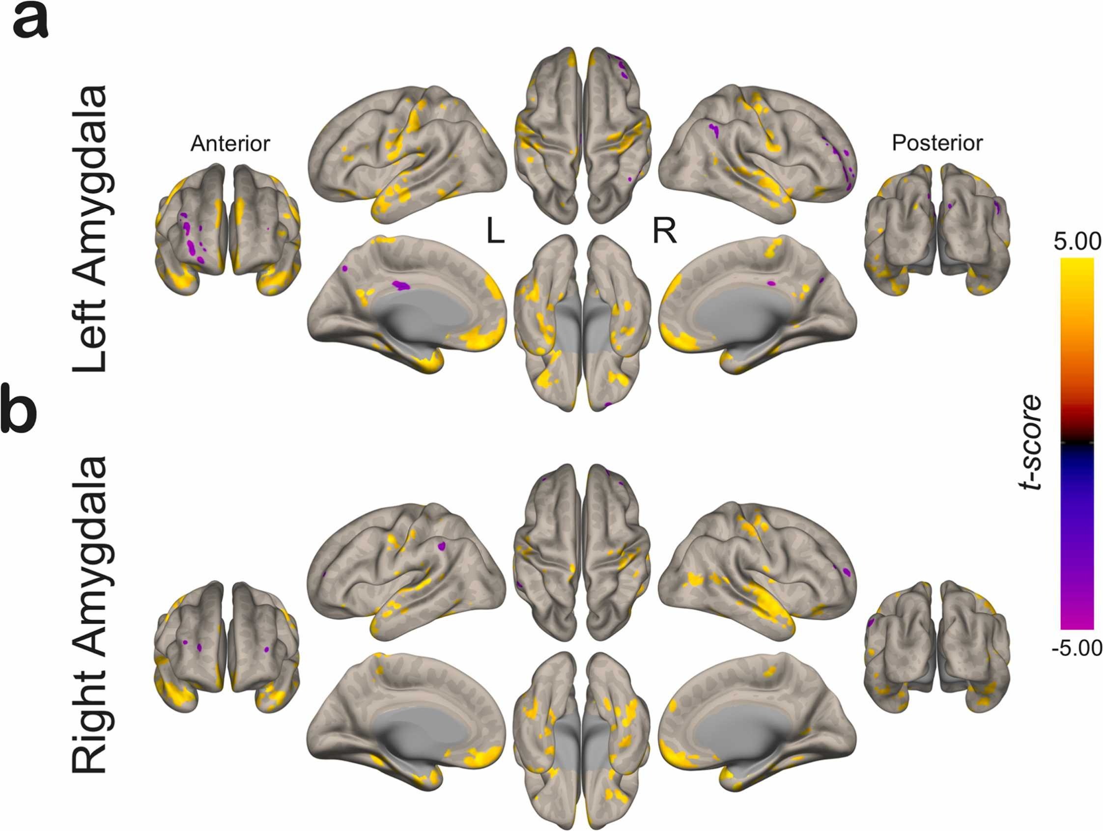 Figure 2 from Serrano et al. 2026: functional connectivity maps of the left (a) and right (b) amygdala