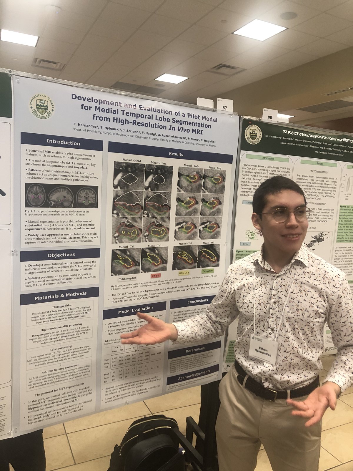 Ethan Hernandez presenting his poster on medial temporal lobe segmentation